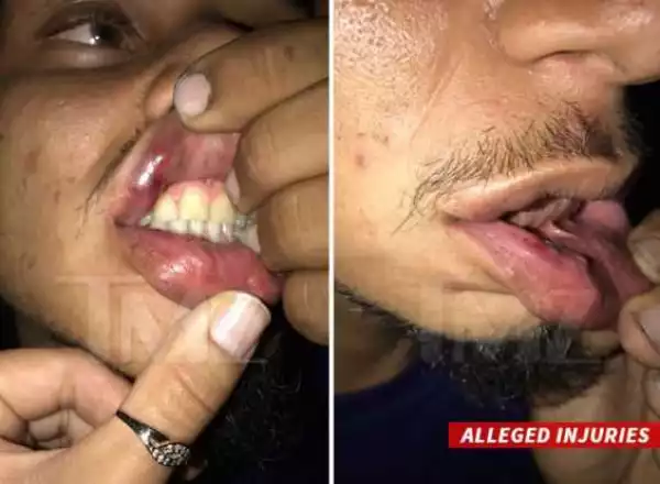 Chris Brown Accused Of Punching Photographer In Nightclub Brawl (Photos)